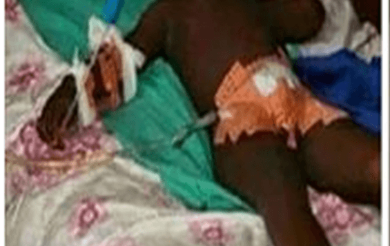 Soweto mother arrested for cutting off stepson’s penis because he urinated on the bed